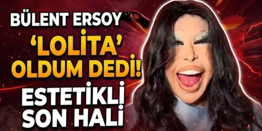 تغییر چهره بولنت ارسوی Bülent Ersoy سایت ترکنما