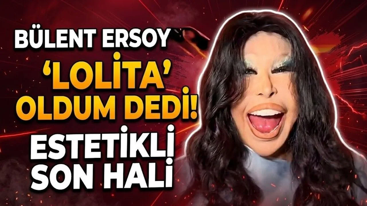 تغییر چهره بولنت ارسوی Bülent Ersoy سایت ترکنما